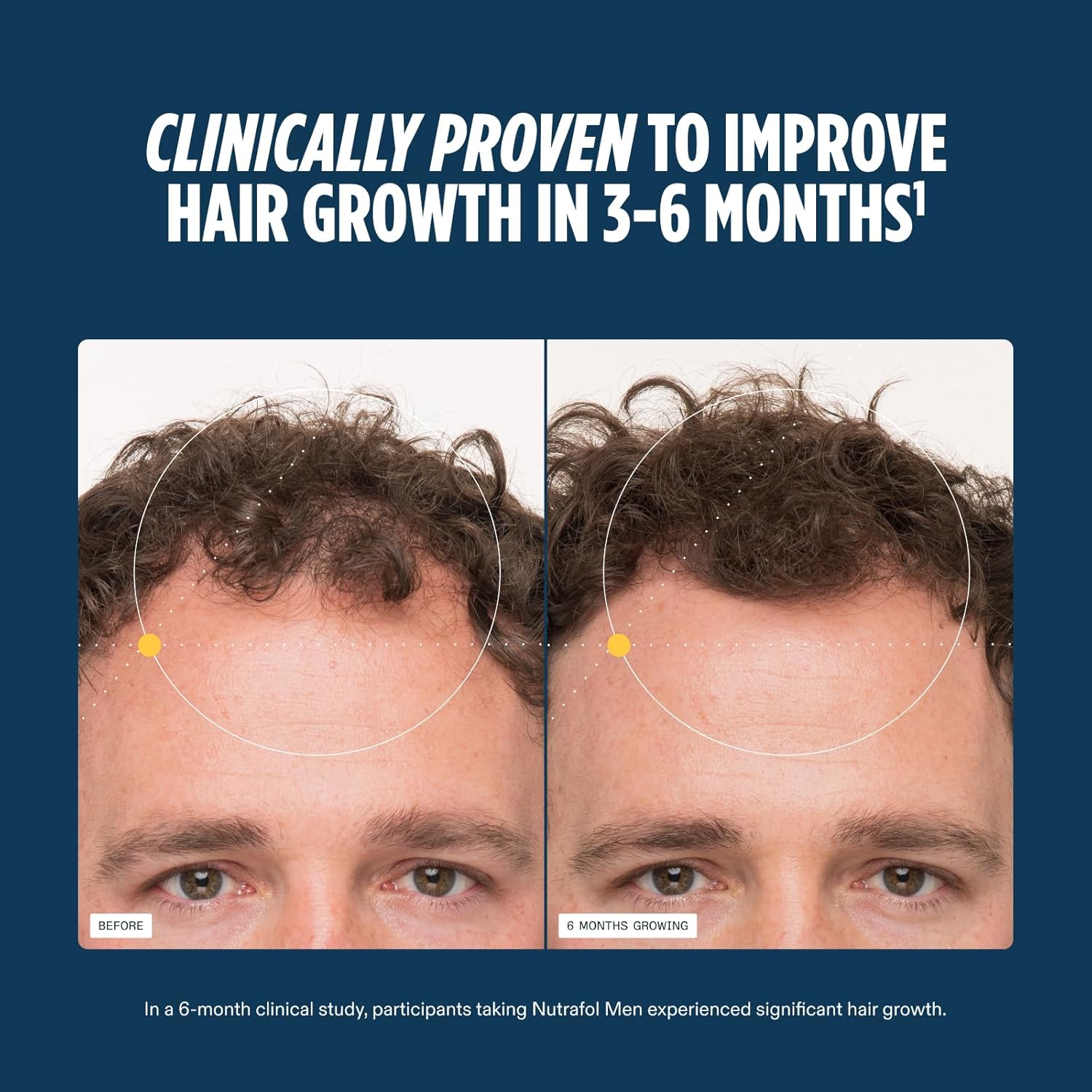 Nutrafol Men's Hair Growth