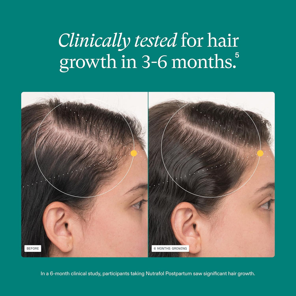 Nutrafol Postpartum Hair Growth