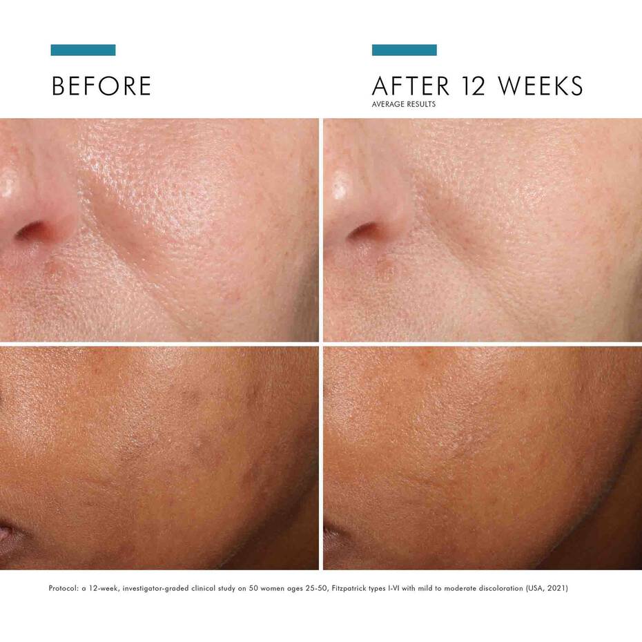 SkinCeuticals | Phloretin CF 30ml