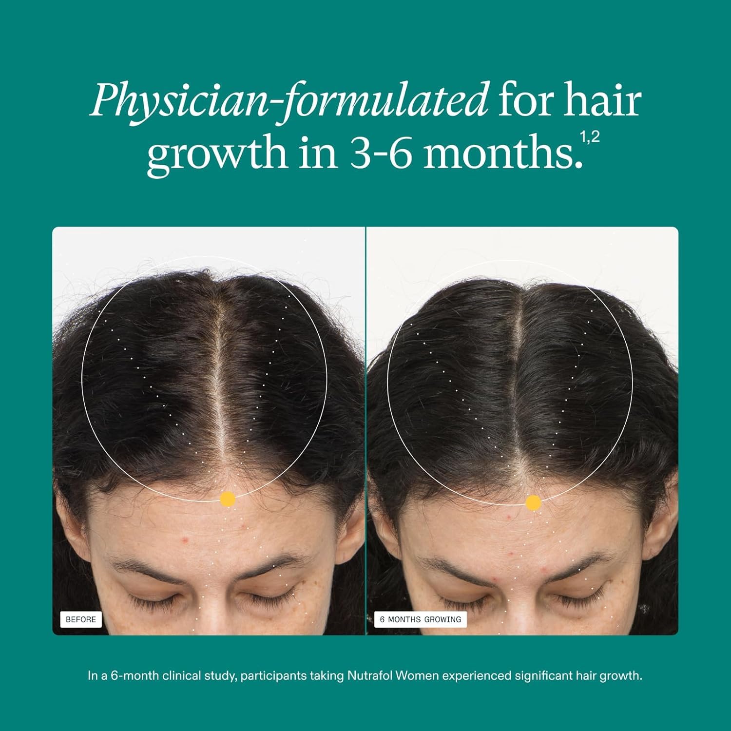 Nutrafol Women's Hair Growth