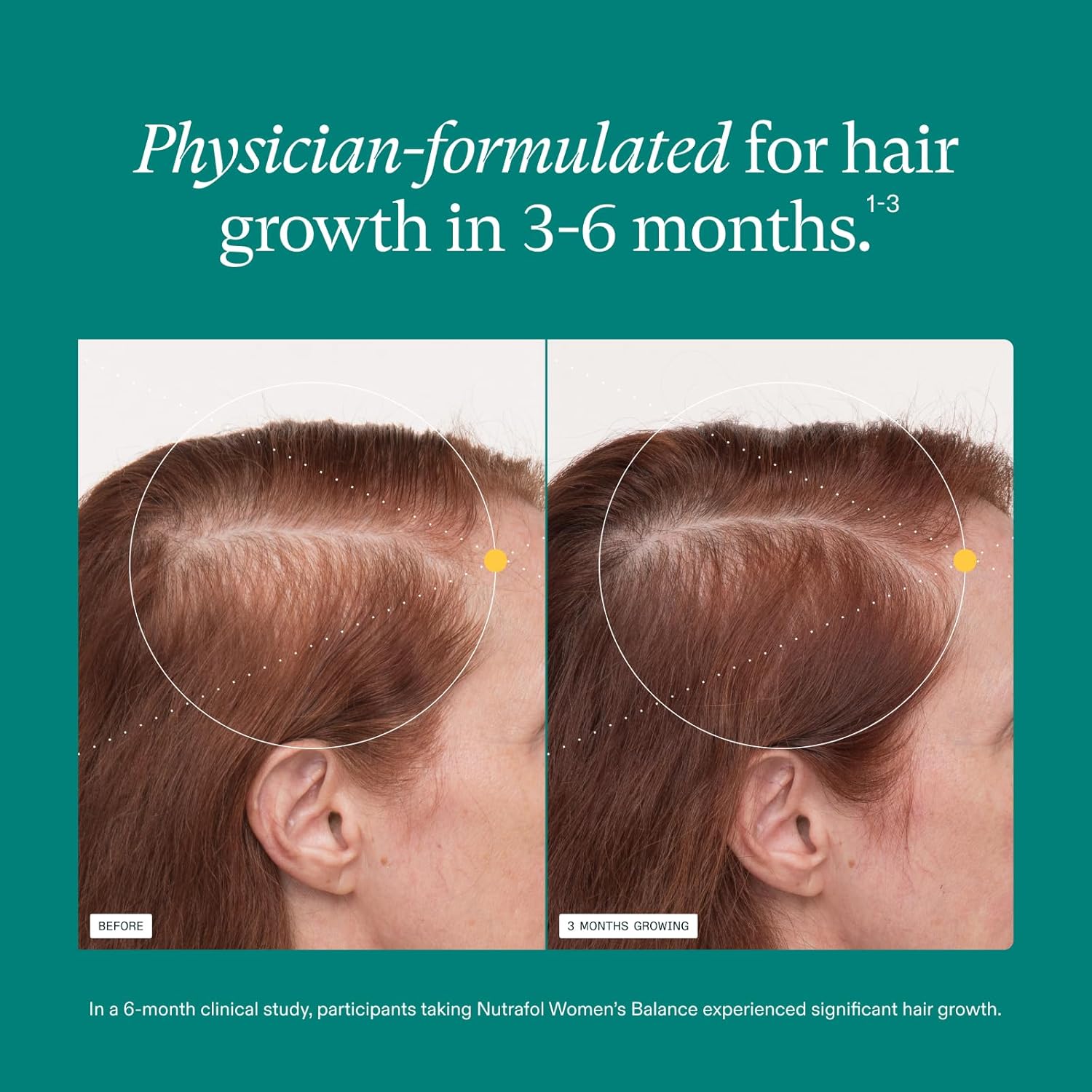 Nutrafol Women's Balance Hair Growth