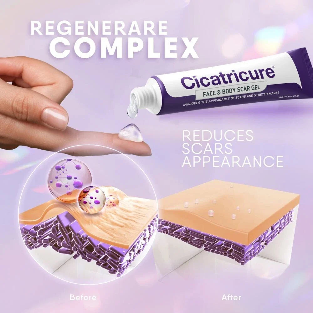 Cicatricure Scar Reducing Cream, Face & Body Scar Gel, 1 oz (30g)
