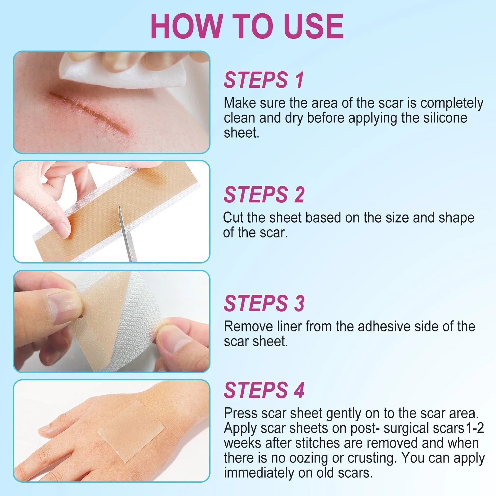 Scar Removal Silicone Tape for Hypertrophic Scars & Keloids, 1.6'' x 75''/150"