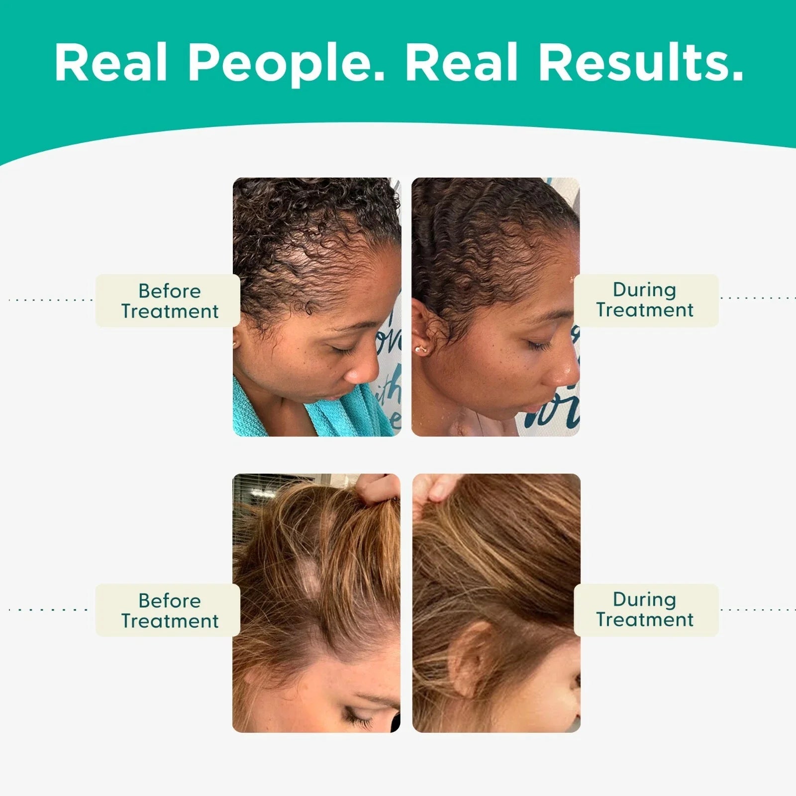 Shapiro MD Hair Growth Experts Hair Loss Shampoo and Conditioner, DHT Fighting Vegan Formula for Thinning Ha