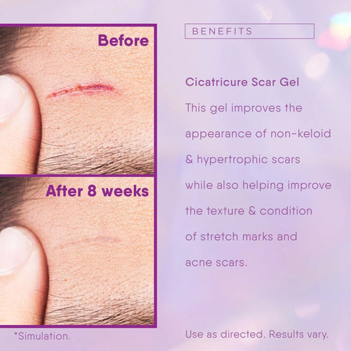 Cicatricure Scar Reducing Cream, Face & Body Scar Gel, 1 oz (30g)