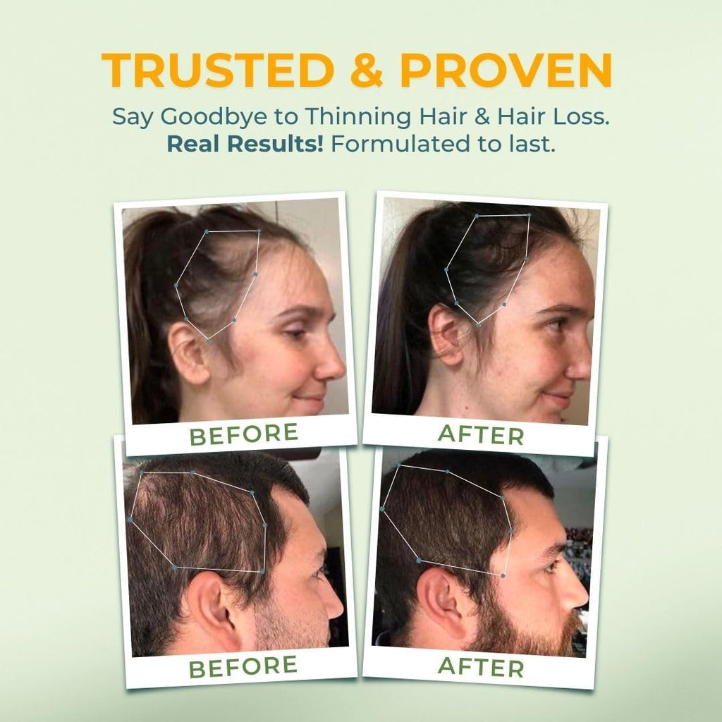 Vital Hair Complex - Hair Growth Vitamins ( 2- Pack )